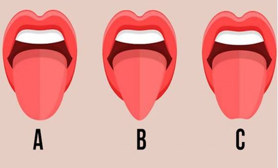 Tudtad, hogy a nyelved formája mennyit elárul rólad?