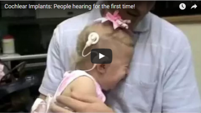 Megható videó, amelyben hallássérültek először hallanak hangokat! 